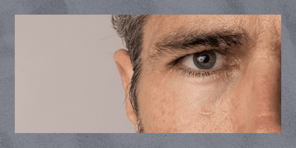 How to Get Rid of Dry Skin On Your Face (For Men)