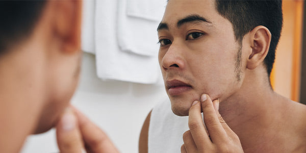 Pimple vs. Boil: What's The Difference?